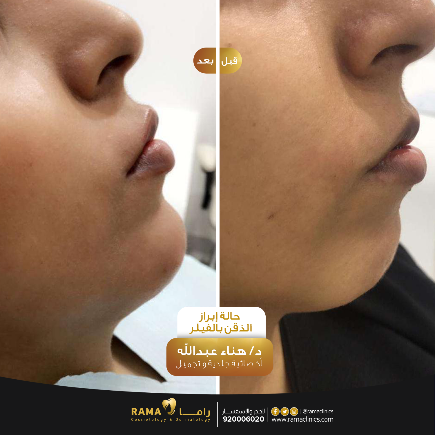 بعد العلاج