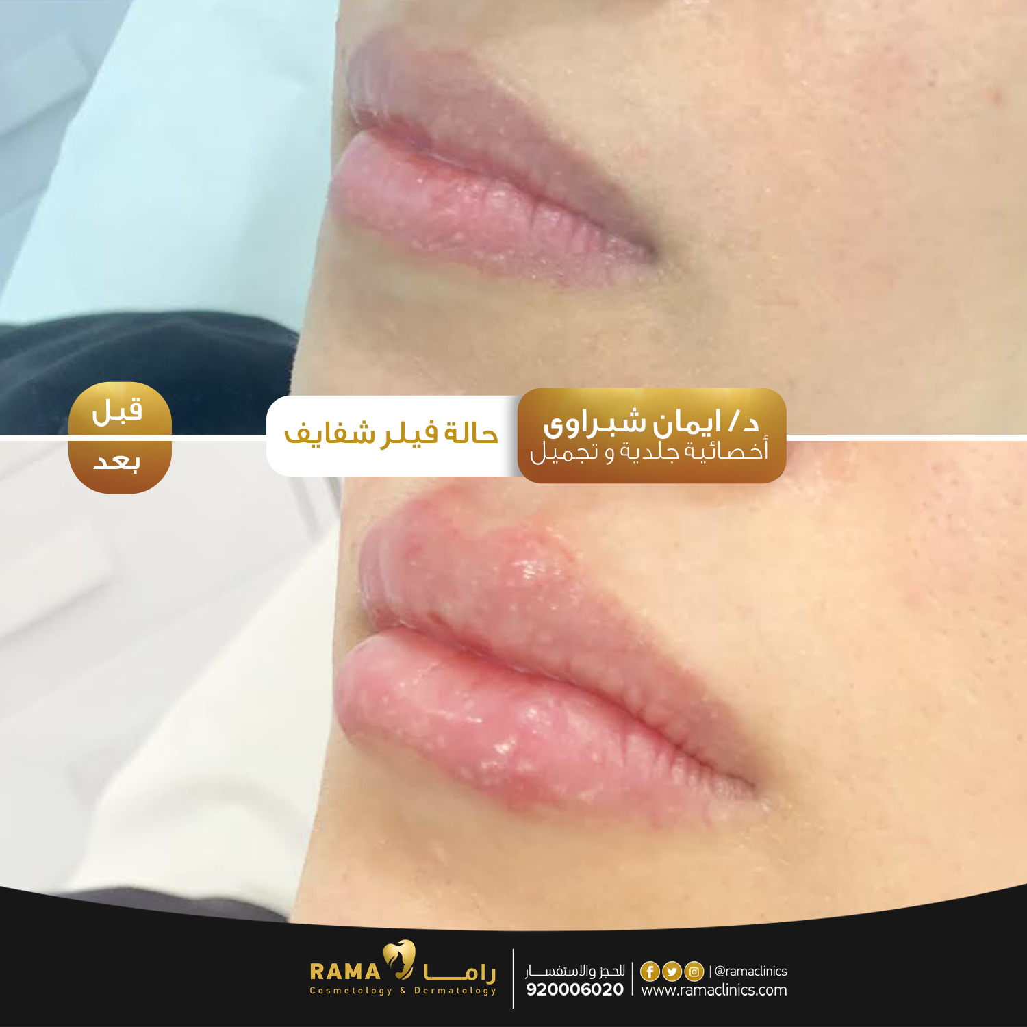 بعد العلاج