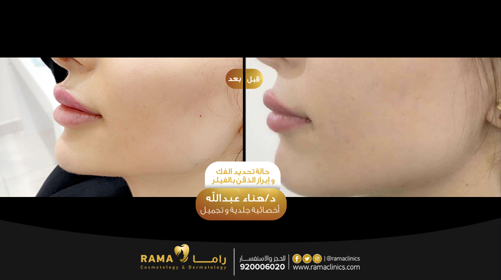 قبل العلاج