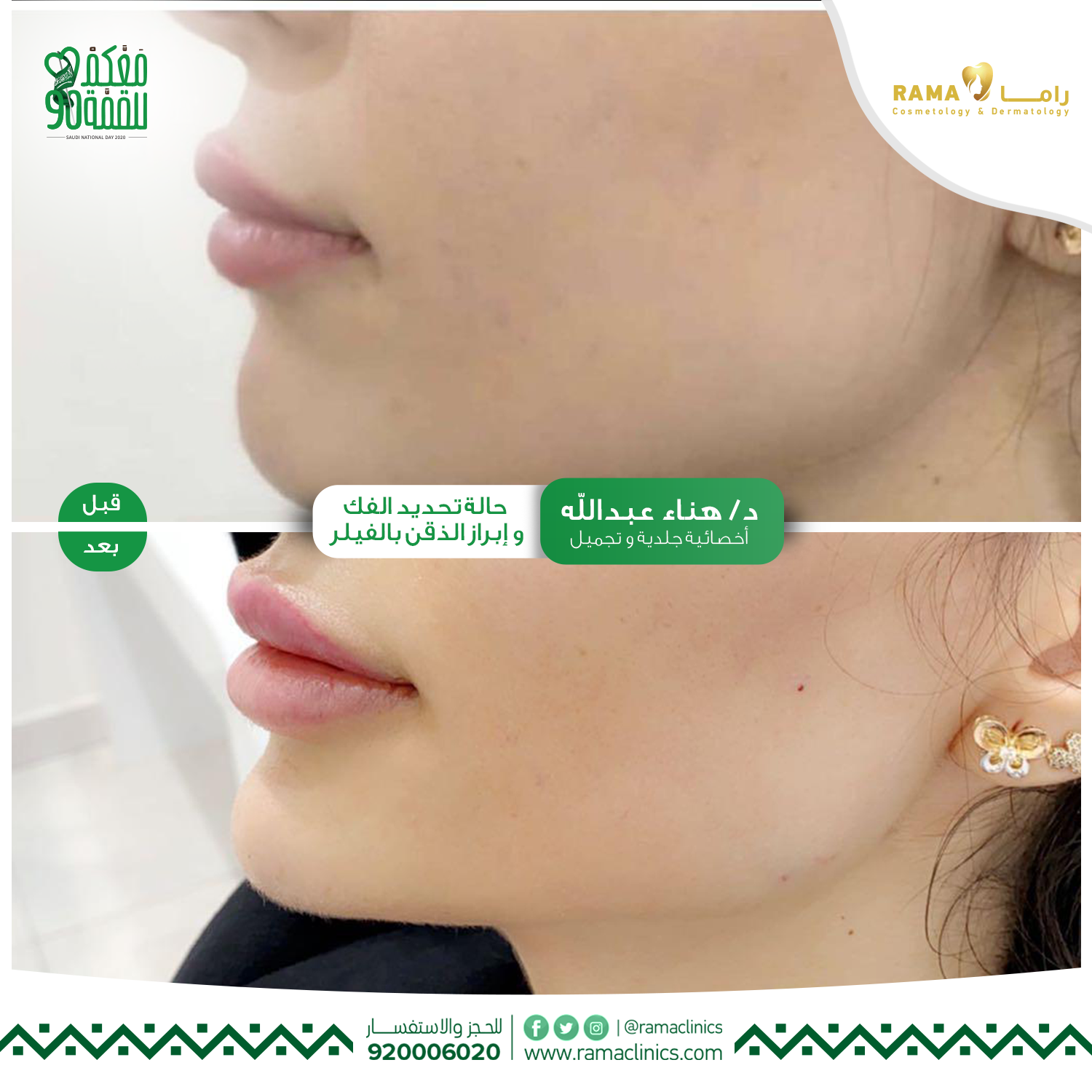 بعد العلاج