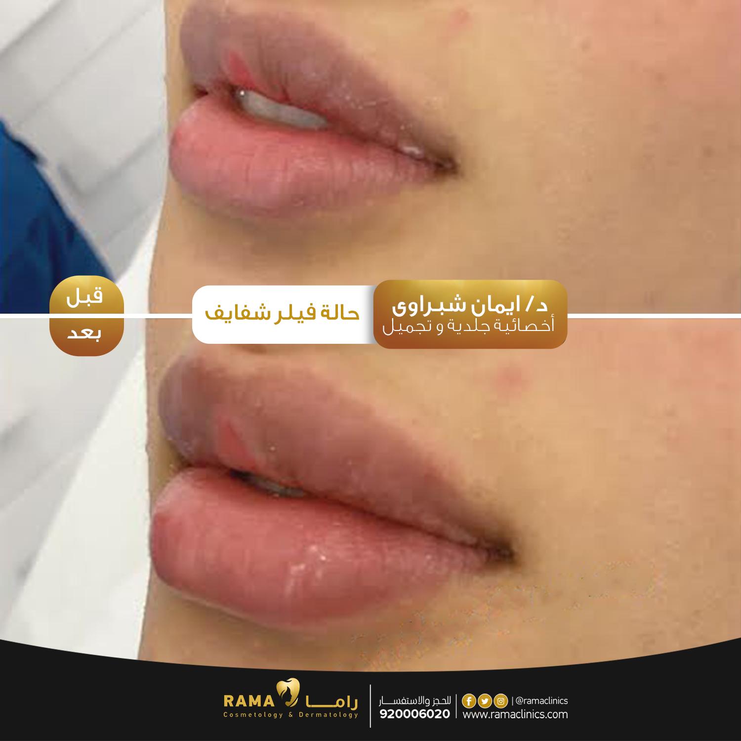 بعد العلاج