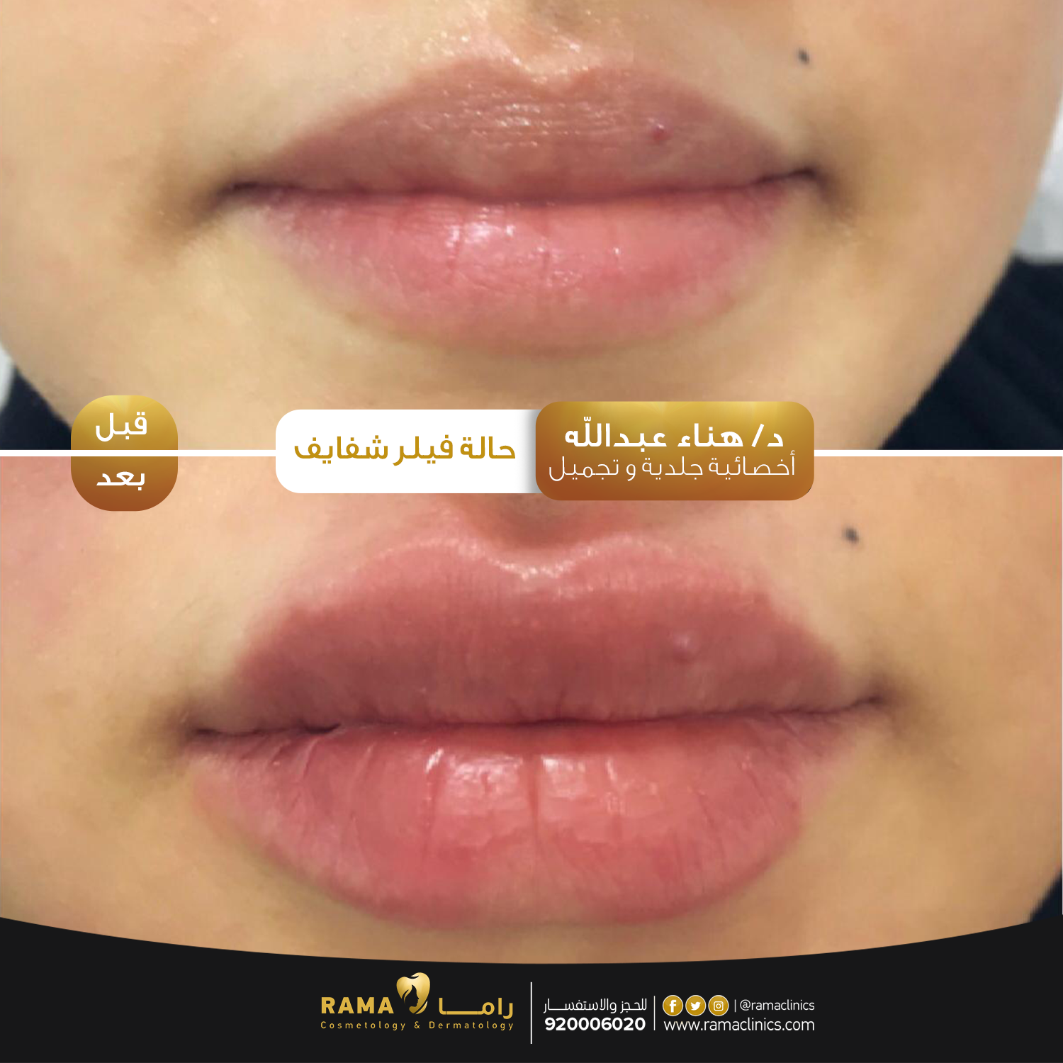 بعد العلاج