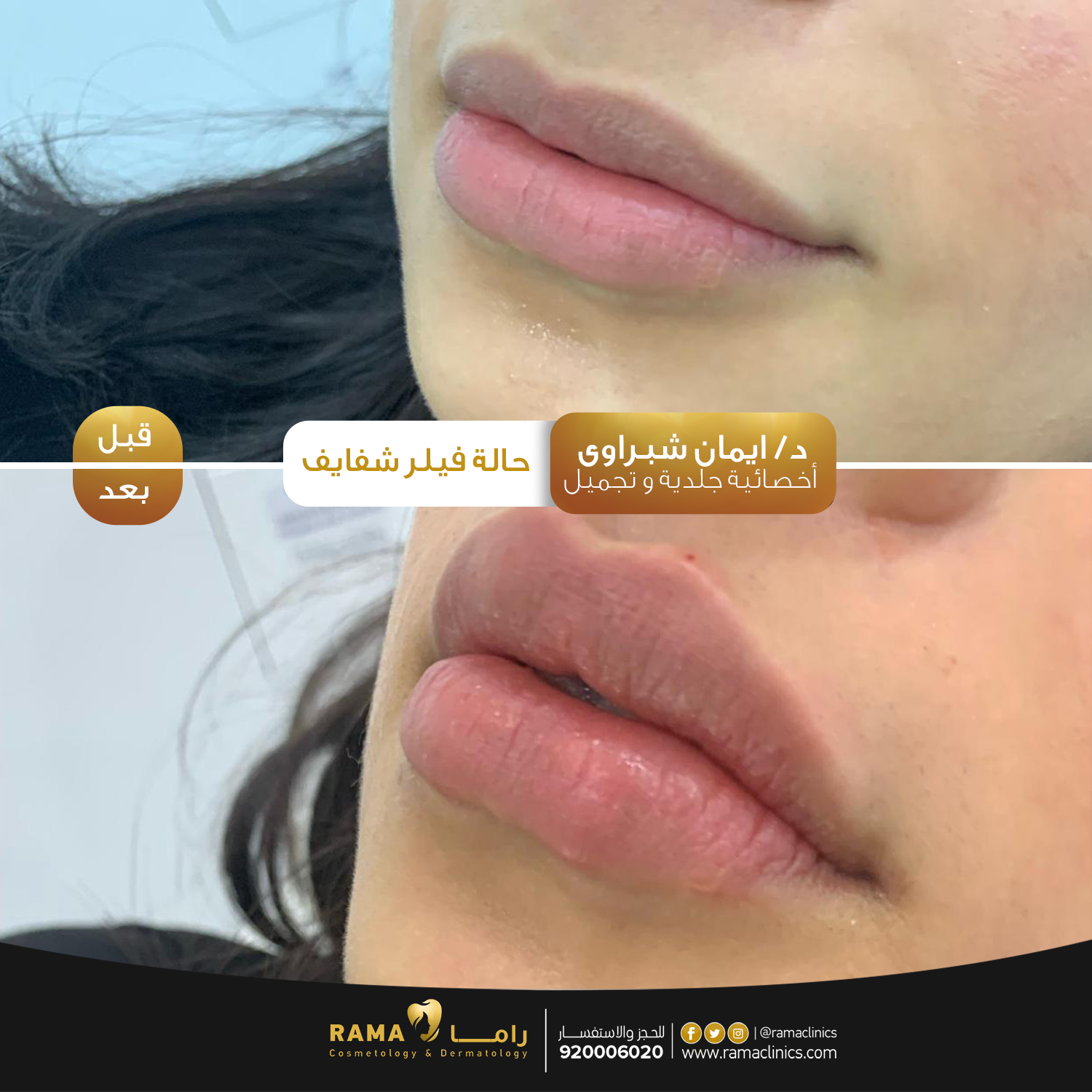 بعد العلاج