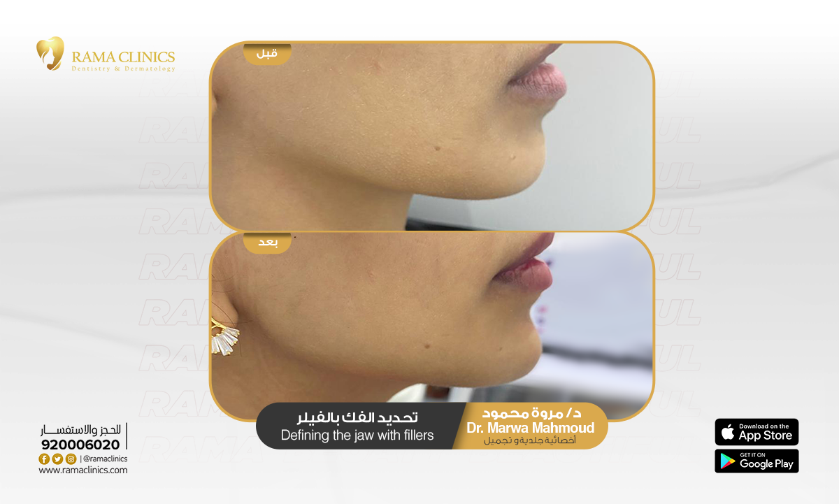 قبل العلاج