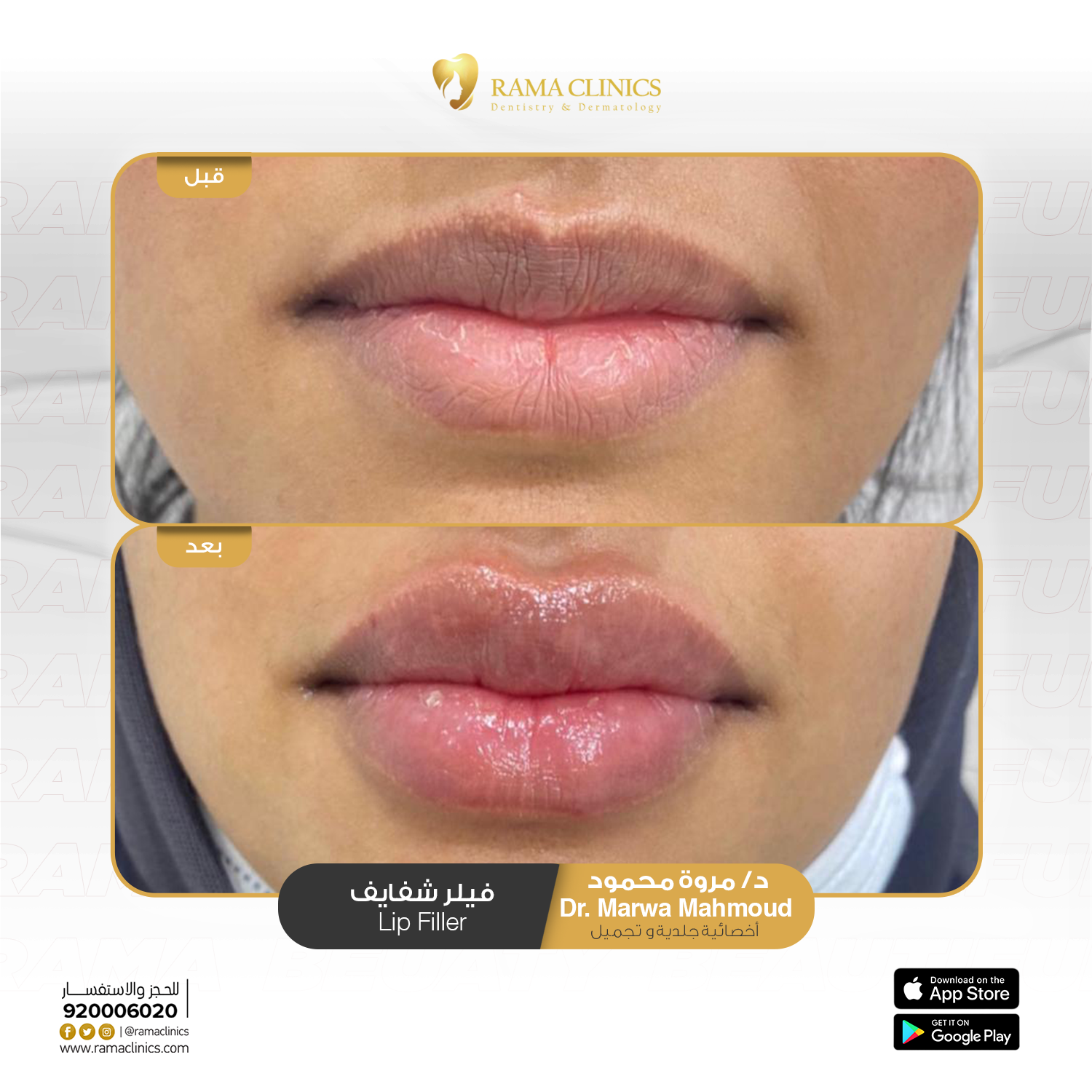 بعد العلاج