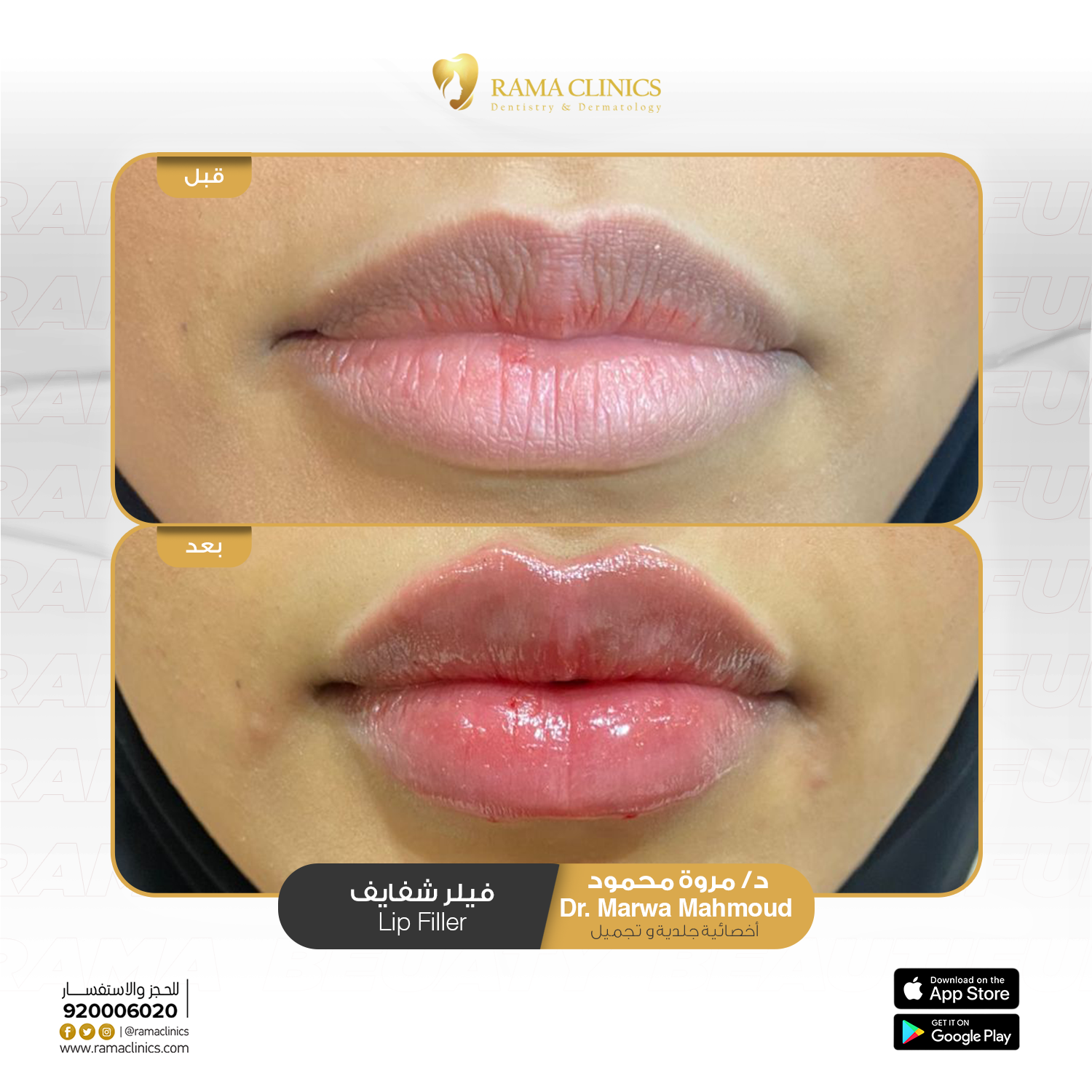بعد العلاج