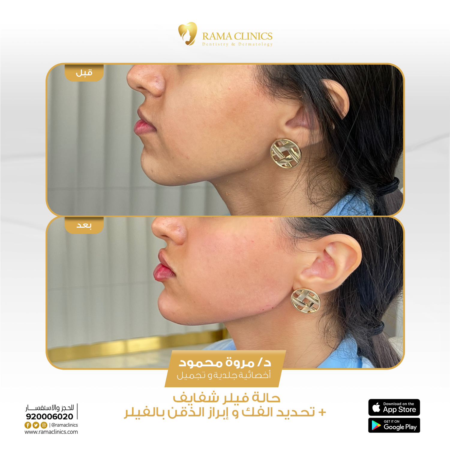بعد العلاج